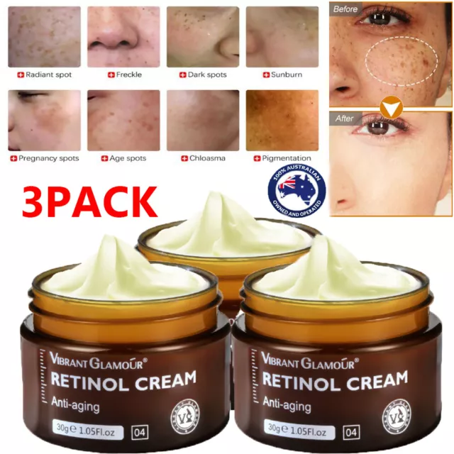 3x Anti-Aging Dark Spot Remover Cream Anti Wrinkle Whitening Face Retinol Cream