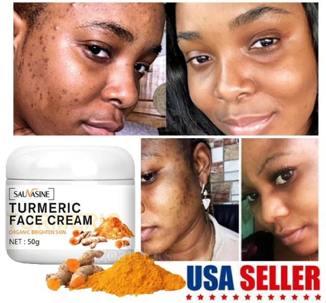 Aufhellcreme Für Achseln & Intimbereich – Dunkle Hautstellen Reduzieren, 30ml