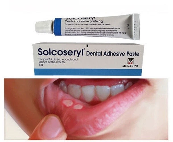 SOLCOSERYL DENTAL ADHESIVE Paste 5g Ulcers Wounds Lesions Mouth Pain