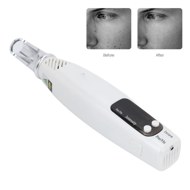 (EU Plug) Handheld-Picosecond-Stift Blaues Licht Tattoo Freckle Dark Spot R GD2