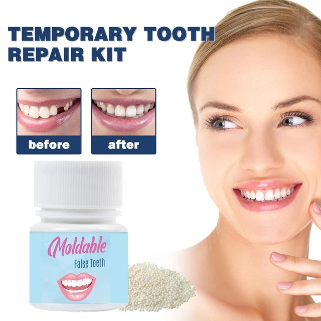 Tooth Repair Granules Temporary Tooth Repair Kit Fitting Beads N E Reusable I7P1
