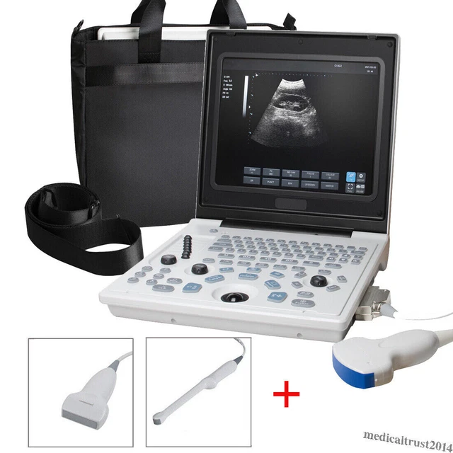 PORTABLE ULTRASOUND SCANNER Laptop Machine Convex+ Linear+ Transvaginal ...