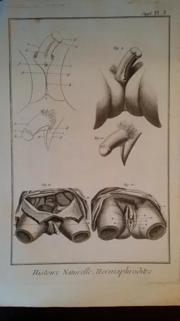 1750 Large Antique Copper Engraving - Histoire Naturelle Hermaphrodites