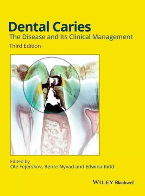 Dental Caries: The Disease and its Clinical Management 3rd Edition by Fejerskov