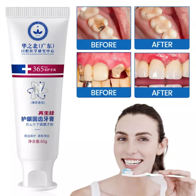 Upgrade Quick Repair of Cavities Caries Removal of Plaque Stains Toothpaste 60g