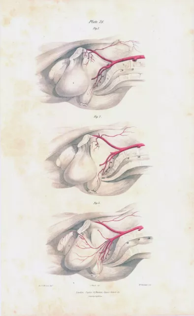 1837 Large Engraving ANATOMY Vascular Reproductive Male Rectal (VA-24)