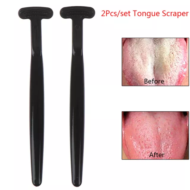 2Pcs/Set Tongue Cleaner Scraper Dental Mouth Oral Clean Heath Care Brush TooB#7H