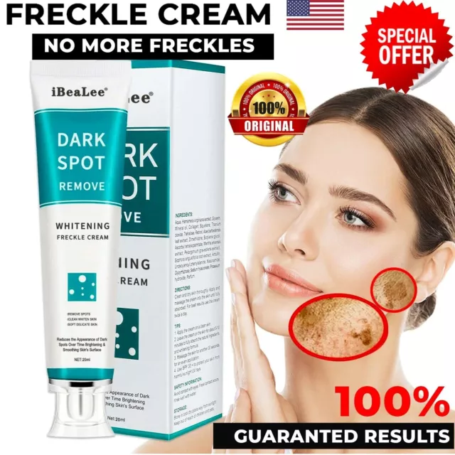 NEW Whitening Freckle Cream Face Moisturizing Remove Dark Spots Melanin Melasma✅