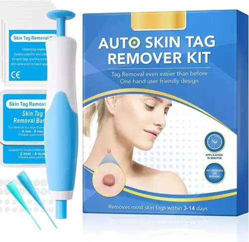 Skin Tag Entferner, schmerzloser Entferner Stift, Hautentfernungs-Kit blau