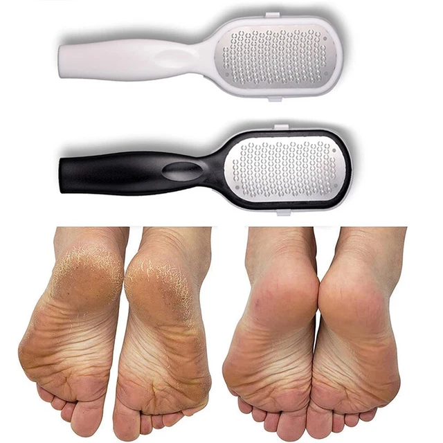 FOOT FILE CALLUS Remover Scrubber Hard Dead Skin Care Exfoliating