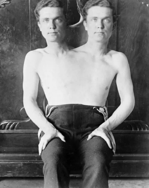 Antique Circus Sideshow Photo 113 Oddleys Strange & Bizarre