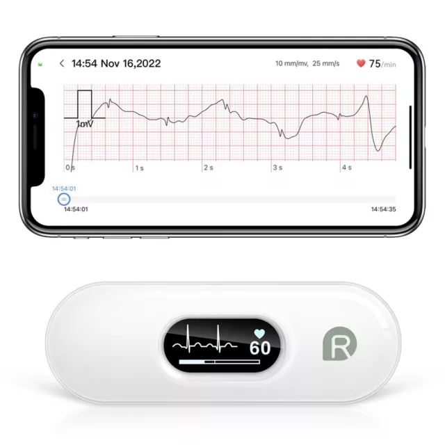 Wireless Personal Mobile EKG Monitor Bluetooth Heart Monitoring with free App