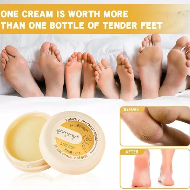 Anti-Cracking Heel Balm Repair Cream for Dry Cracked Feet