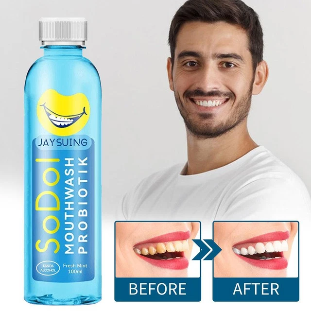 Enjuague bucal brillante blanqueador dental eliminación de manchas dentales, curación de úlceras bucales-100 ml