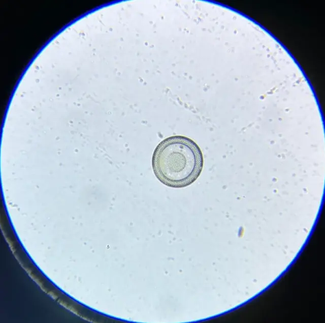 A.C. Cole Microscope Slide Diatom Craspedodiscus Elegans Nottingham Maryland
