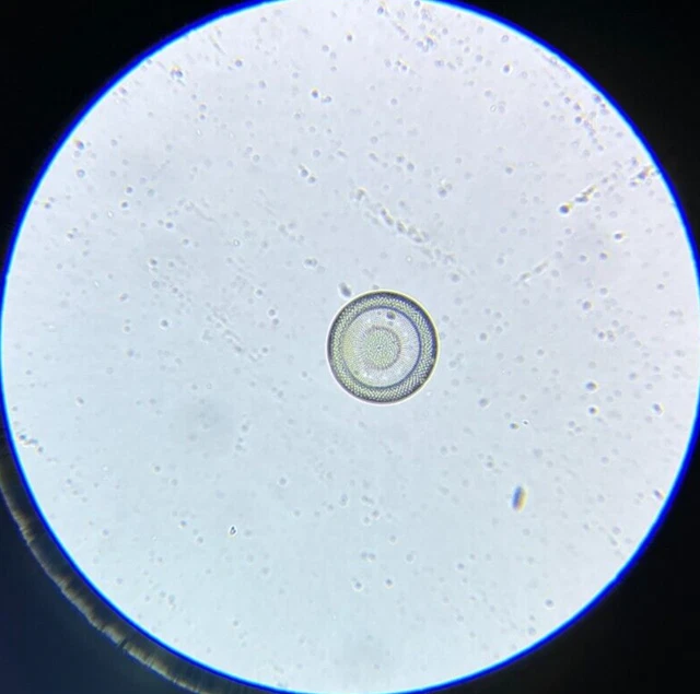 A.C. Cole Microscope Slide Diatom Craspedodiscus Elegans Nottingham Maryland