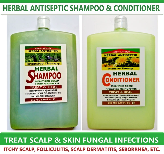 ITCHY SORE SCALP Anti HairLoss AntiDandruff Mites Shampoo