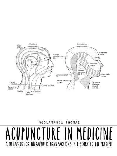 Acupuncture in Medicine : A Metaphor for Therapeutic Transactions in History ...