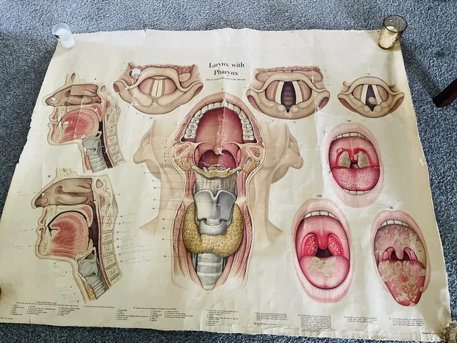 Medical Leaning vintage Chart  Larynx with Pharynx. probably 30’s, very large.