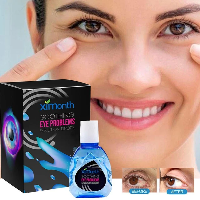 Gotas calmantes para el tratamiento de problemas oculares ATTDX RÁPIDO