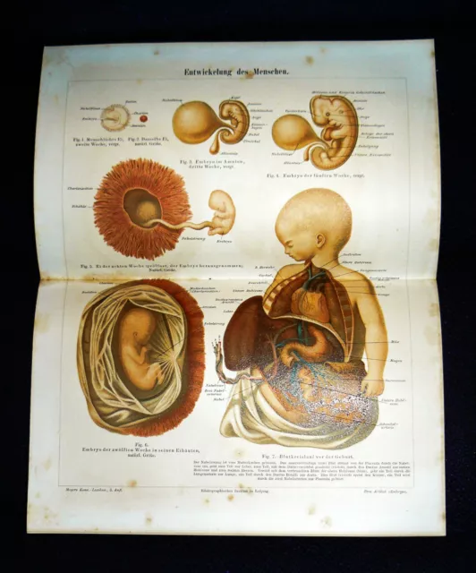 ENTWICKLUNG des MENSCHEN Lithographie von 1894 – 127 Jahre ORIGINAL