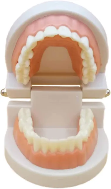 Dental Model Implant Bridge Dentist Research Explanation Small Size Pink