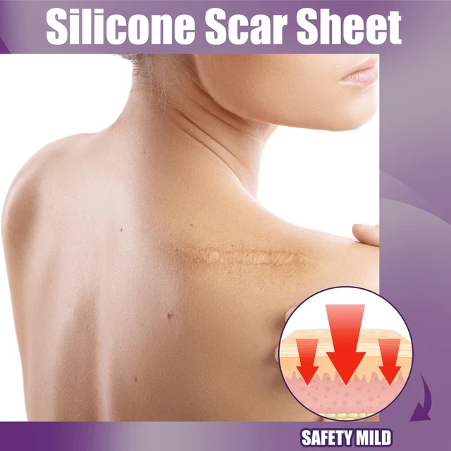 8x fogli cicatrici in silicone morbidi appiattiti cicatrici smagliature rimozione cicatrici TDM