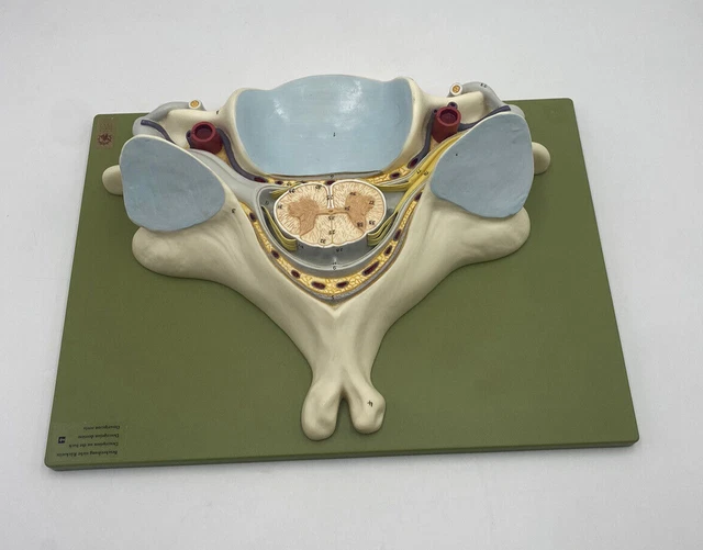 Somso Anatomical Model - Spinal Cord Section - BS 30