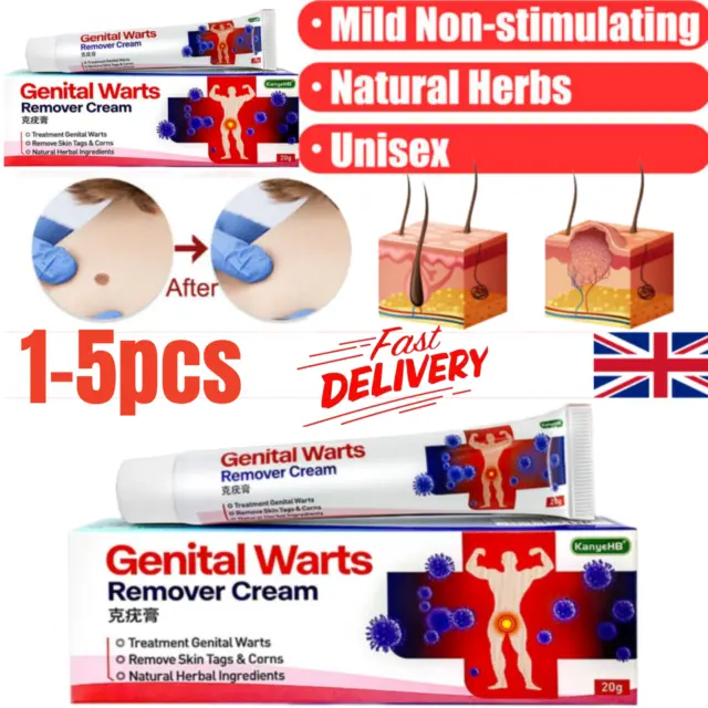 Genital Herpes Wart Remover-Ointment SkinTag Mole Acuminatum Treatment Cream UK