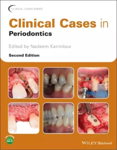 Nadeem Karimbux Clinical Cases in Periodontics (Poche)