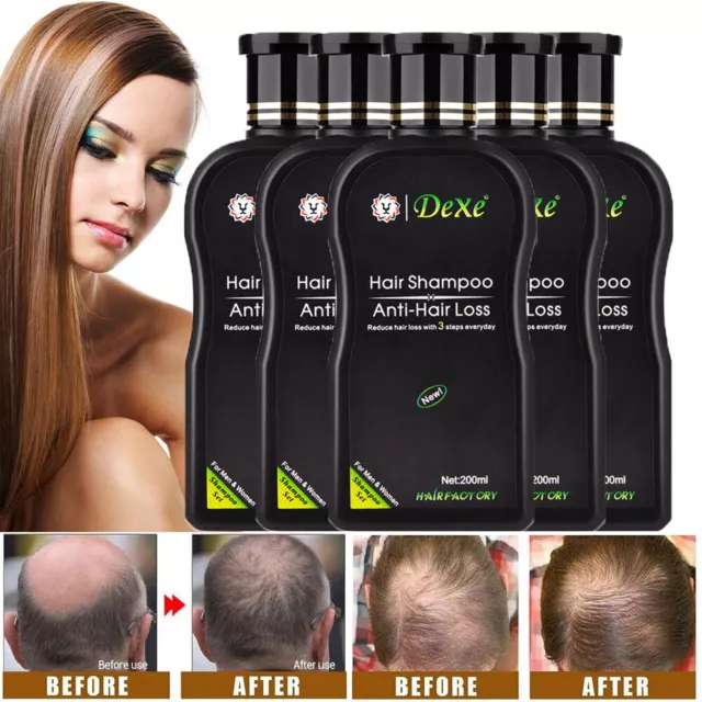 200ML DEXE Anti-Hair Loss Shampoo Chinese Herbal Hair Regrowth for Men & Women
