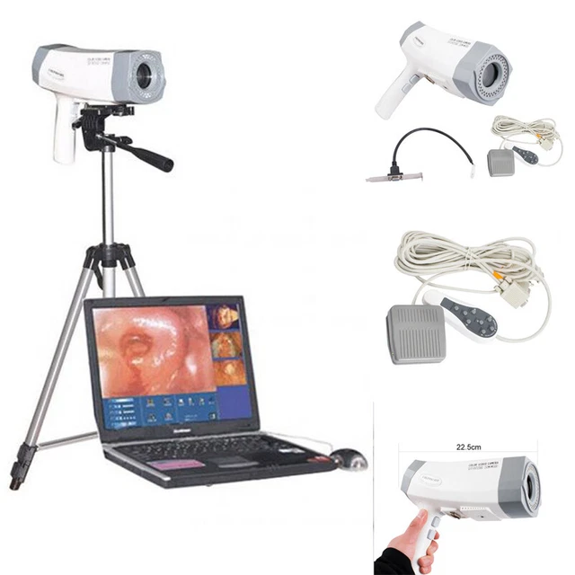 Carejoy Best Video Sony Camera Electronic Colposcope 480k Pixels Software+Tripod