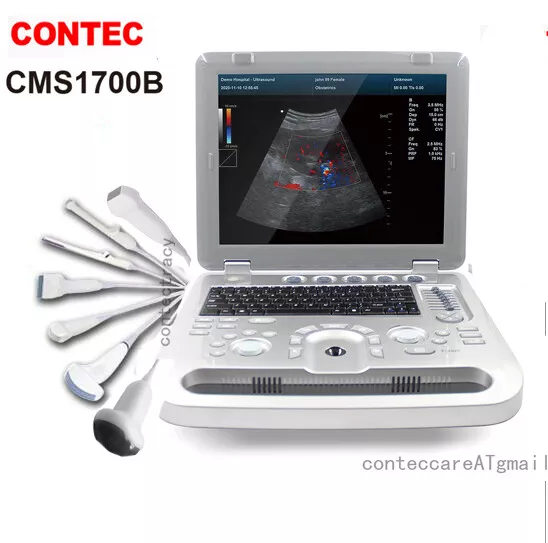 CONTEC Color Doppler Ultrasound Scanner Portable Laptop Machine Optional 7 Probe