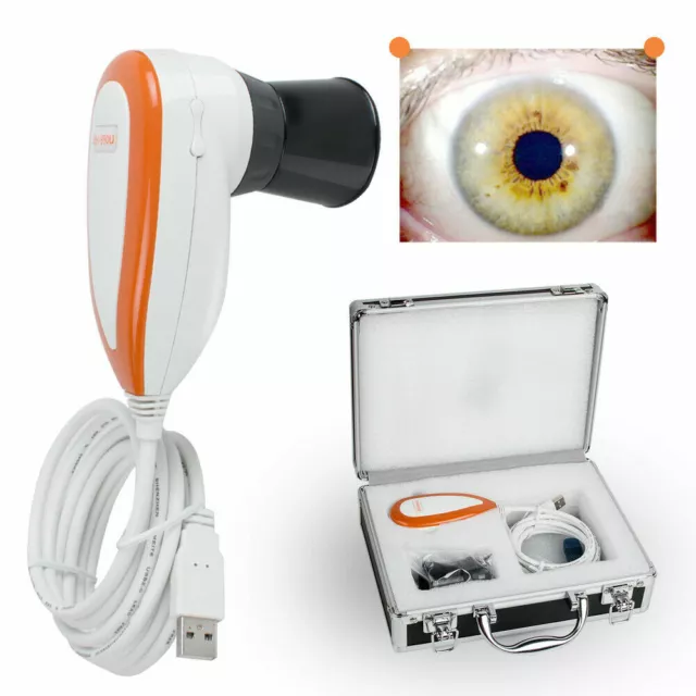 Analizzatore fotocamera iridologia iriscopio USB 5 MP 2560x1920 software fotocamera iridologia