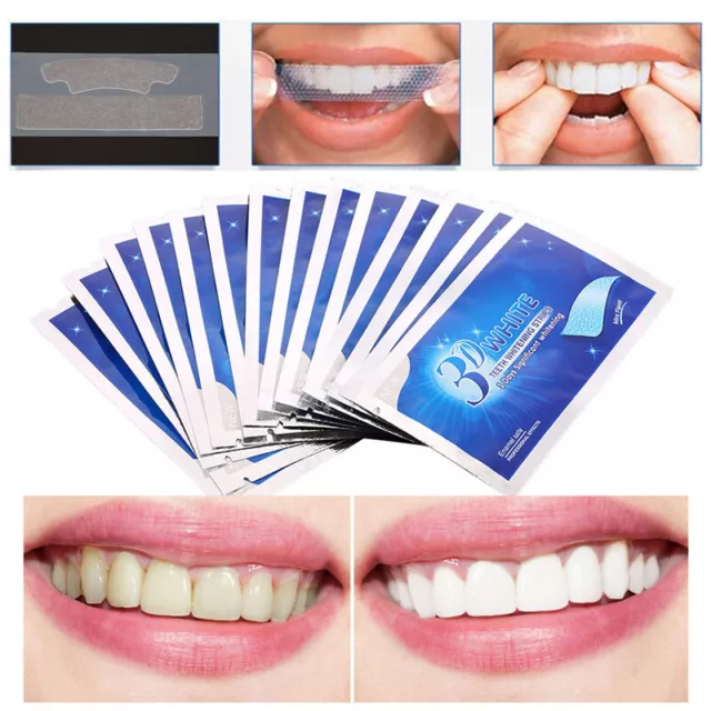 28Pcs Ultra White Professional Teeth Whitening Strips Dental Tooth Whitener