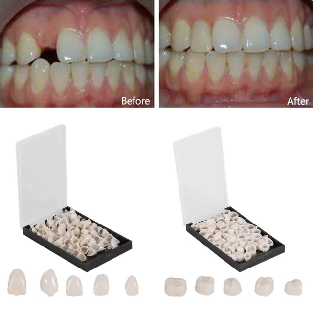 Dental Temporary Crown Material for Anterior Teeth Molar Tooth Porcelain 1 Box