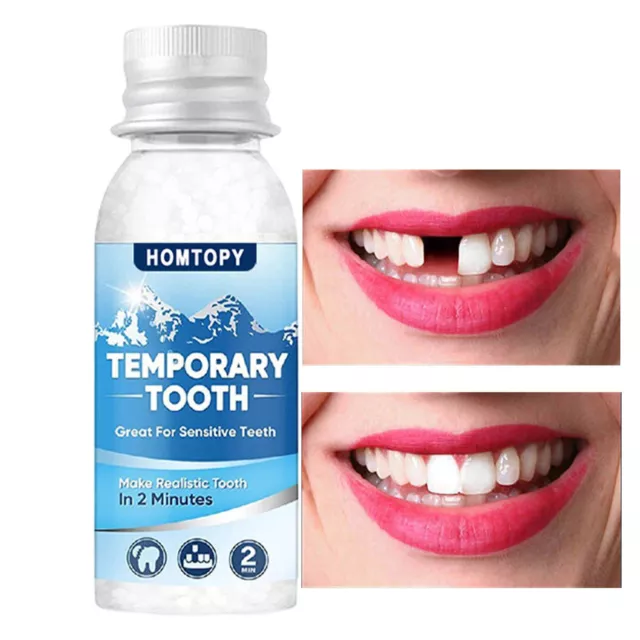MISSING TOOTH TEMPORARY Teeth Replacement Repair False Diy Temp Tooth  $19.99 - PicClick AU