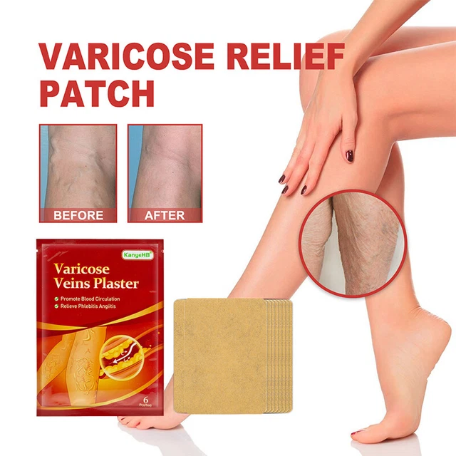 VENENENTZ NDUNG ODER H MATOM INFIZIERTES visual data 5