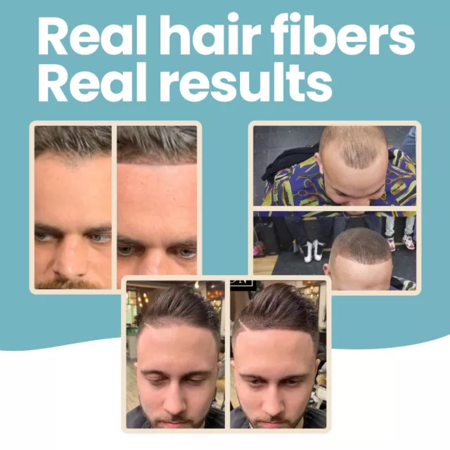 Beard & Hairline Optimizer Fibers for Receding Hairline by HAIR ILLUSION - 38g