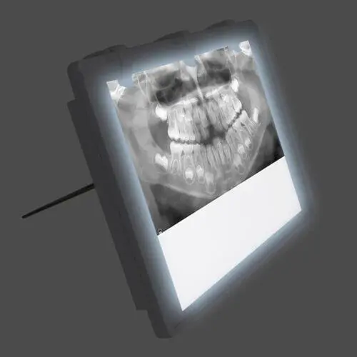 Dental X-Ray Film Illuminator adjustable Light Box X-ray Viewer light A4 Panel