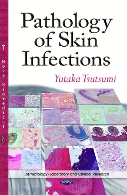 Pathology of Skin Infections by Yutaka Tsutsumi (English) Hardcover Book