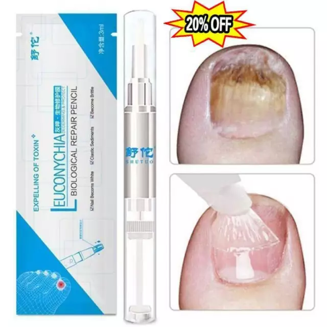 FUNGUS STOP Pencil - Anti Fungal Nail Repair Treatment Fingernails Toenails P0J5