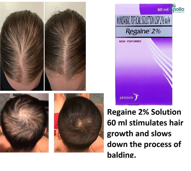 Regaine Minoxidiil 2% solución para el cuero cabelludo pérdida de cabello para mujeres fuerza regular 60 ml