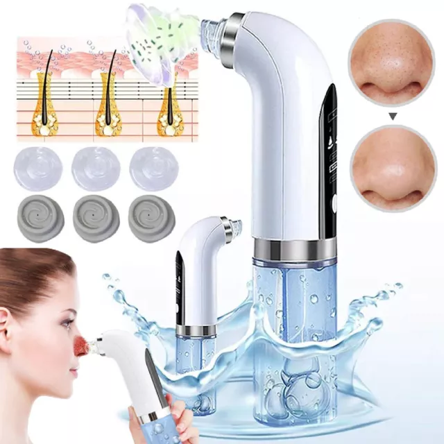 Electric Blackhead Remover Vacuum Acne Pore Cleaner Facial Suction Cleaning Kit