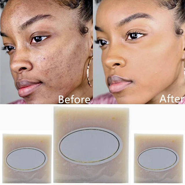 DARK SKIN PERMANENT Bleaching Soap Whitening Brightening Lightening