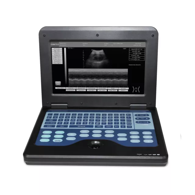 FDA CE 10.1 Inch Portable Ultrasound Scanner Laptop Machine CMS600P2 For Human 2