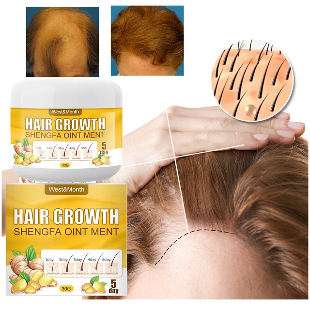 Champú esencial para el crecimiento del cabello jengibre, jengibre para detener la pérdida del cabello