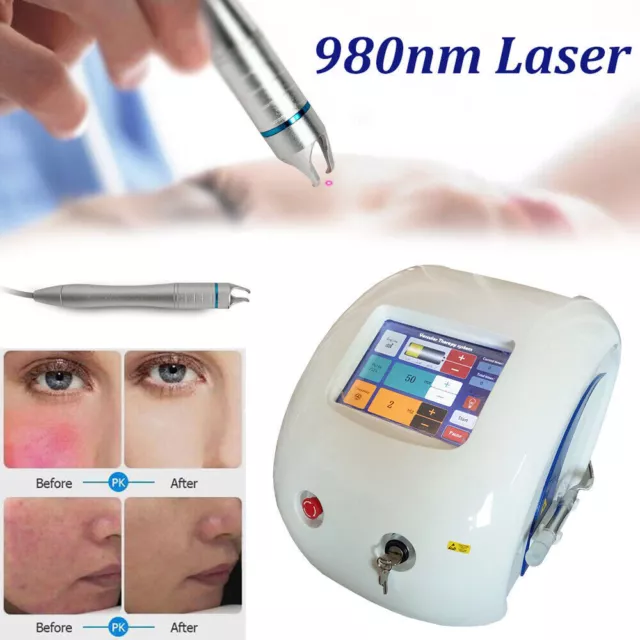 Máquina profesional de belleza facial con láser de diodo de 980 nm para eliminar venas arañas facial uso spa