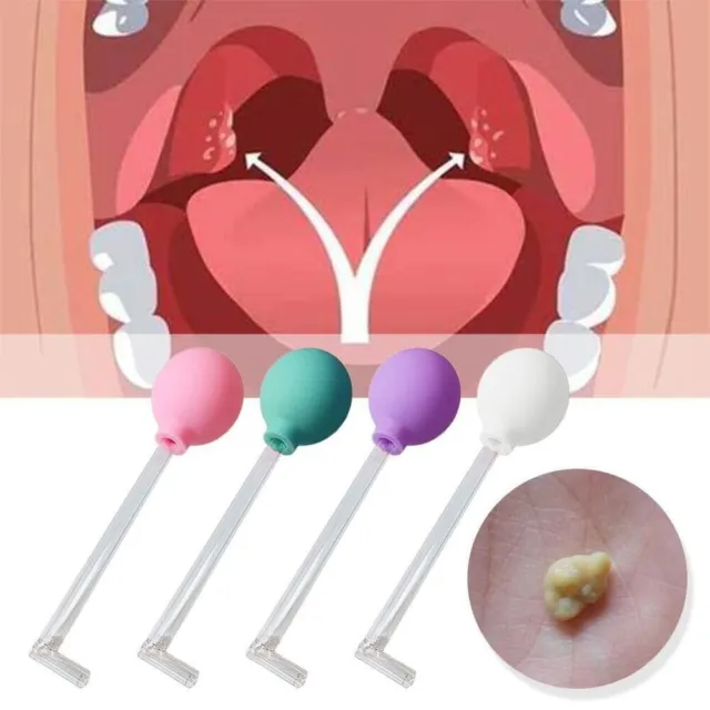 Utensilien Mundpflege Die Mundhöhle reinigen Entfernung von Tonsillen steinen