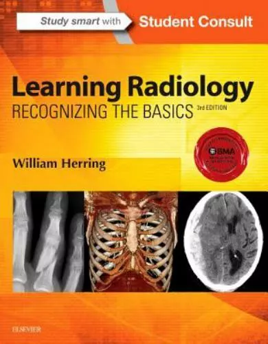 Learning Radiology: Recognizing the Basics - paperback, FACR, 0323328075